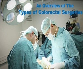 An Overview of The Types of Colorectal Surgeries
