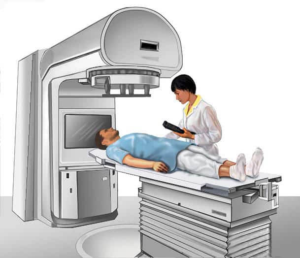 patient-external-radiation-illustration