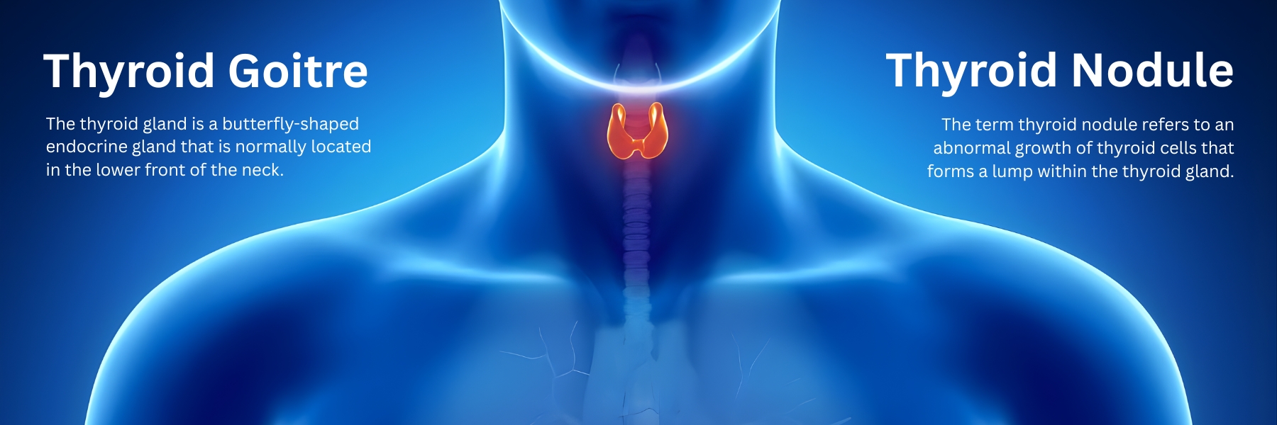Best Thyroid Surgeon and Center in Dubai