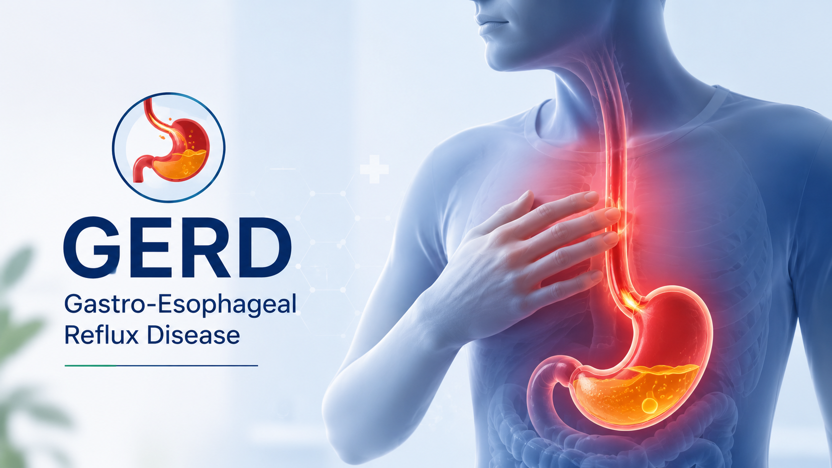 Gastro-Esophageal Reflux disease GERD