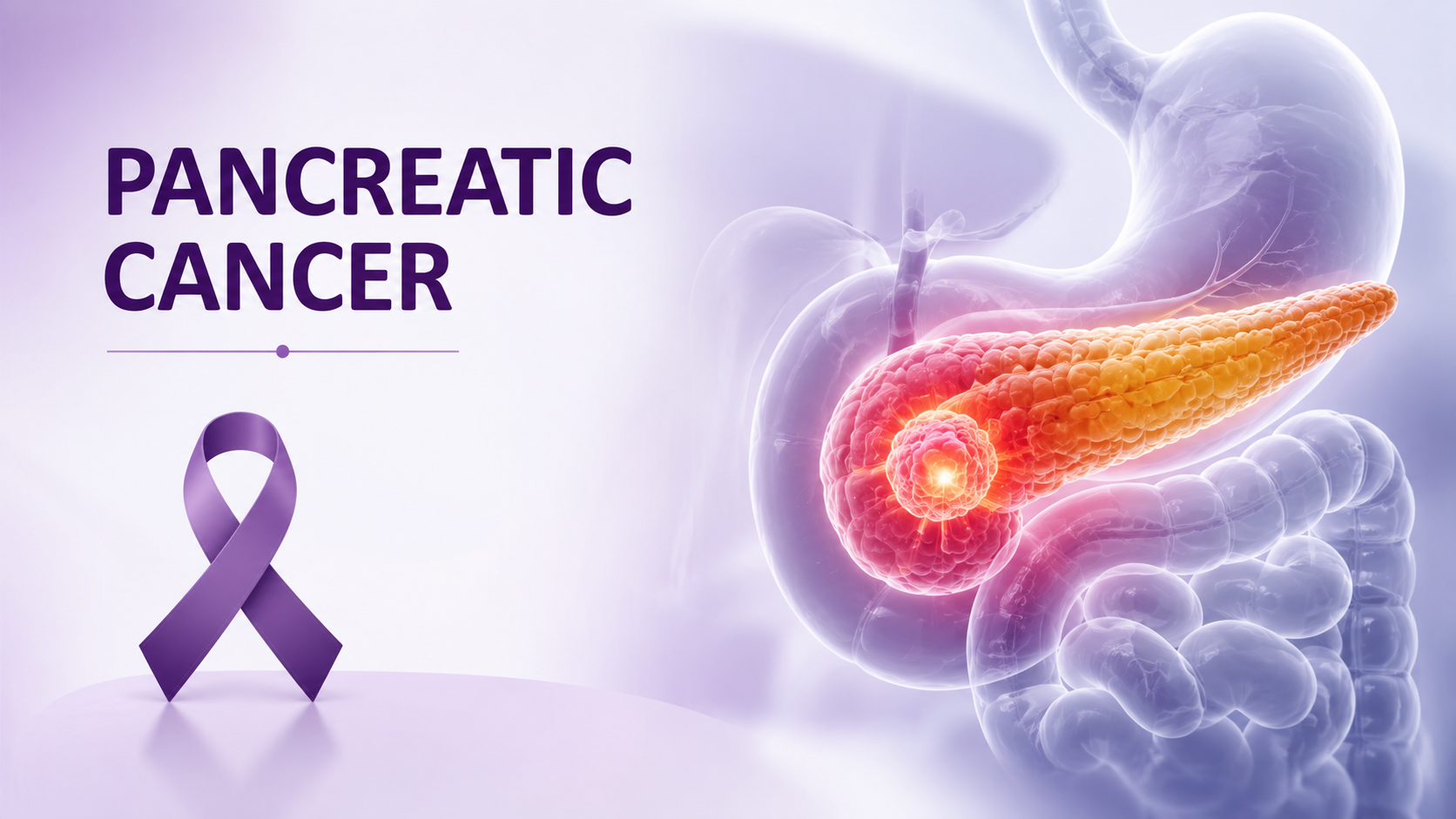 Pancreatic Cancer